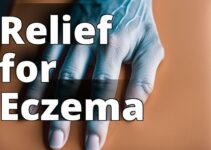 The Ultimate Guide To Using Cbd Oil For Effective Eczema Treatment